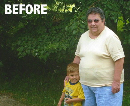 Brenda Badish Before